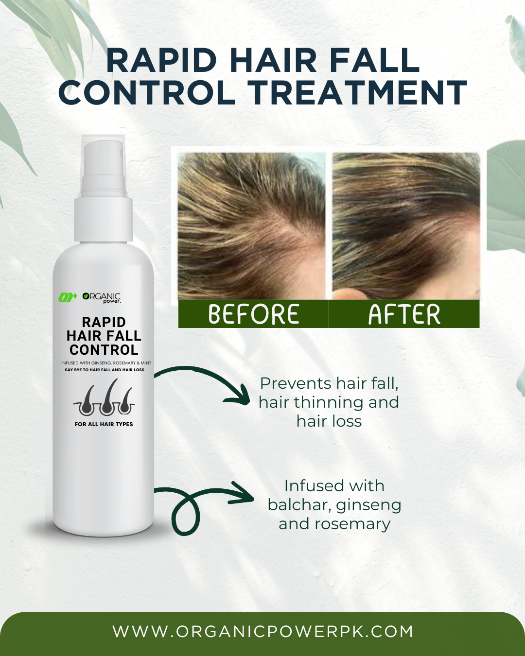 Rapid Hair Fall Control Treatment – 100% Natural Solution for Hair fall Stronger, Healthier Hair